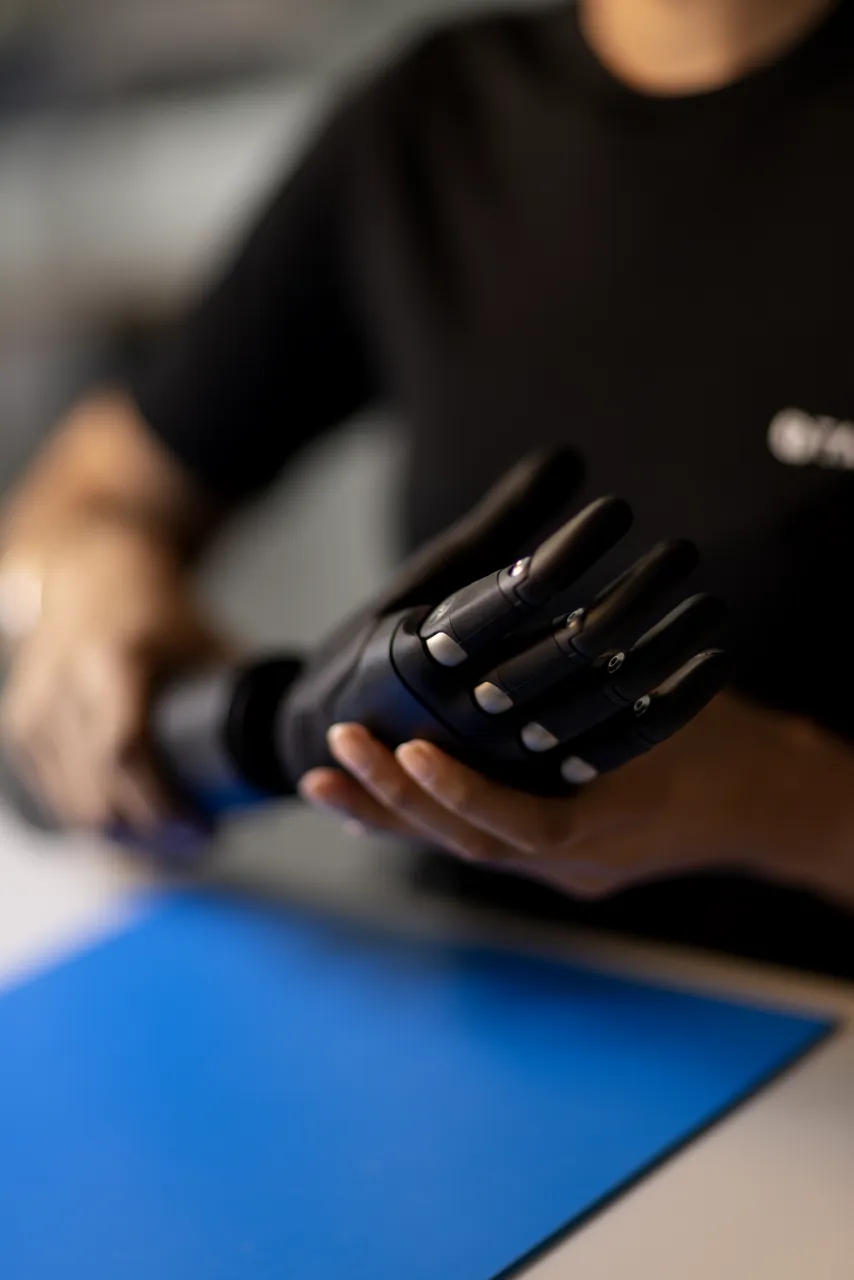 Prosthetic hand manufacturing